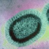 タミフル耐性インフルエンザが各地で拡大　静岡でも新たに検出