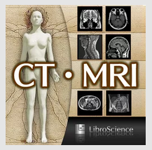 CT・MRI解体新書   Google Play の Android アプリ