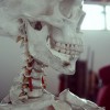 骨の移植負担軽減へ　東大らが高い骨形成能力のある合成人工骨を開発