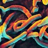 エボラ出血熱　未承認薬投与を受けたリベリア人医師死亡