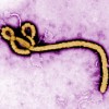 エボラ出血熱治療に期待　富士フイルム「アビガン錠」追加生産へ